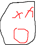 dead person
